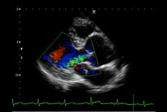 超音波検査画像