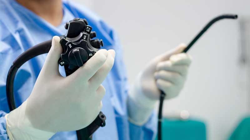 胃と大腸の内視鏡